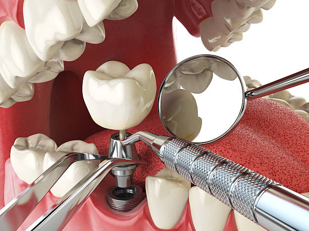 Best Emergency TMJ Treatment in Lebanon, OH